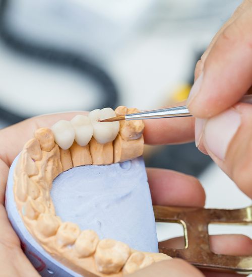 dentist working on dental bridge